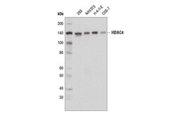 Cell Signaling Technology&nbsp;HDAC4 D8T3Q Rabbit mAb 100 u