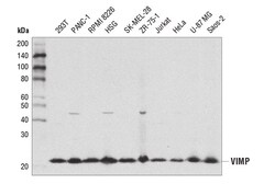Cell Signaling Technology&nbsp;VIMP D1D1M Rabbit mAb 100 ul
