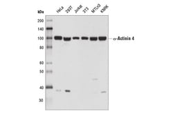 Cell Signaling Technology&nbsp;alpha-Actinin 4 D7U5A Rabbit