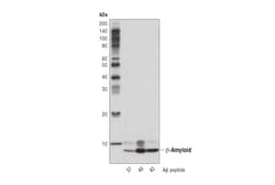 Cell Signaling Technology&nbsp;beta-Amyloid D3D2N Mouse mAb
