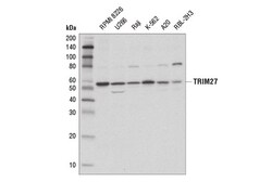 Cell Signaling Technology&nbsp;TRIM27 D5S4O Rabbit mAb 100