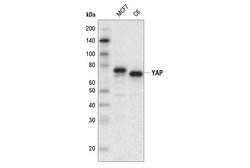 Cell Signaling Technology&nbsp;YAP D8H1X XPRRabbit mAb