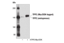 Cell Signaling Technology&nbsp;TPP2 Antibody 100 ul