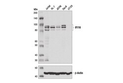 Cell Signaling Technology&nbsp;IFI16 D8B5T Rabbit mAb 100 u