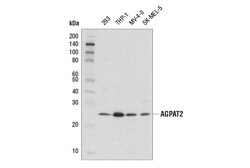 Cell Signaling Technology&nbsp;AGPAT2 D8W9B Rabbit mAb 100