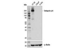 Cell Signaling Technology&nbsp;Integrin beta-4 D8P6C XPR