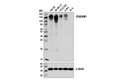 Cell Signaling Technology&nbsp;CEACAM1 D1P4T Rabbit mAb 100