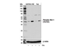Cell Signaling Technology&nbsp;Phospho-Mcl-1 Thr163 D5M9D