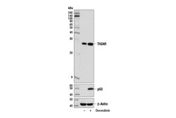 Cell Signaling Technology&nbsp;TIGAR D3F4A Rabbit mAb 100 u