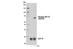 Cell Signaling Technology&nbsp;Phospho-SLP-76 Ser376 D9D6E
