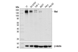 Cell Signaling Technology&nbsp;Ret E1N9A Rabbit mAb 100 ul