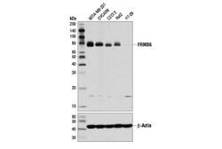 Cell Signaling Technology&nbsp;FRMD6 D8X3R Rabbit mAb 100 u