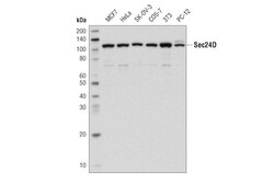 Cell Signaling Technology&nbsp;Sec24D D9M7L Rabbit mAb 100
