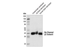 Cell Signaling Technology&nbsp;Na Channel beta-2 Subunit D1S