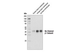 Cell Signaling Technology&nbsp;Na Channel beta-1 Subunit D9T