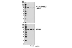 Cell Signaling Technology&nbsp;Phospho-ALK Tyr1507 D6F1V
