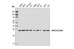 Cell Signaling Technology&nbsp;ANT2/SLC25A5E2B9D Rabbit mA