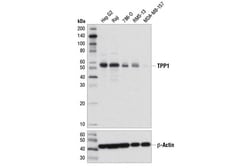 Cell Signaling Technology&nbsp;TPP1 D4E2R Rabbit mAb 100 ul