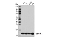 Cell Signaling Technology&nbsp;Sec61B D5Q1W Rabbit mAb 100