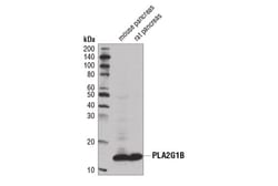 Cell Signaling Technology&nbsp;PLA2G1BD1T4C Rabbit mAb 100