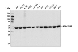 Cell Signaling Technology&nbsp;ATP6V1B2D2F9R Rabbit mAb 10