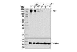 Cell Signaling Technology&nbsp;Ret E1N8X XP lt/ sup gt R