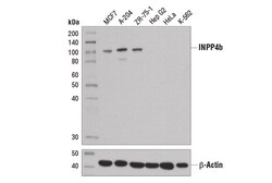 Cell Signaling Technology&nbsp;INPP4b D9K1B XPR Rabbit mA