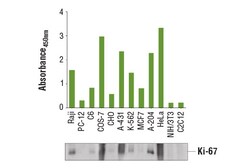 Cell Signaling Technology PathScanRTotal Ki-67 Sandwi, Quantity: Each of