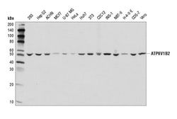 Cell Signaling Technology&nbsp;ATP6V1B2 D3O7Q Rabbit mAb 10