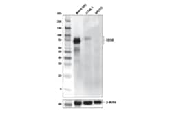 Cell Signaling Technology&nbsp;CD39/NTPDase 1 E2X6B XPR R