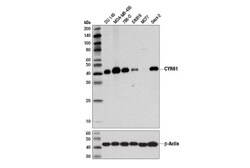 Cell Signaling Technology&nbsp;CYR61 D4H5D XPR Rabbit mAb