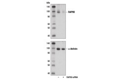 Cell Signaling Technology&nbsp;RAP80 D1T6Q Rabbit mAb 100 u