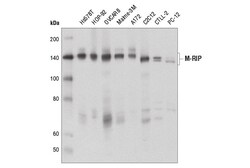 Cell Signaling Technology&nbsp;M-RIP D8G8R Rabbit mAb 100 u
