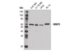 Cell Signaling Technology&nbsp;MMP-3 D7F5B Rabbit mAb 100 u