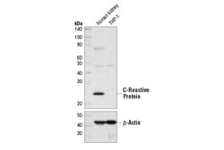 Cell Signaling Technology&nbsp;C-Reactive Protein D1N1U Rab