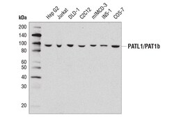 Cell Signaling Technology&nbsp;PATL1/PAT1b D8P1B Rabbit mAb