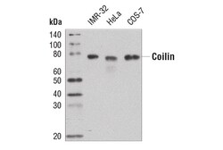 Cell Signaling Technology&nbsp;Coilin D2L3J XPR Rabbit mA