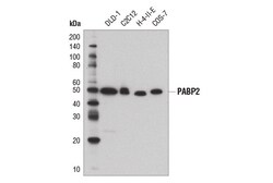 Cell Signaling Technology&nbsp;PABP2 D6F3Q Rabbit mAb 100 u