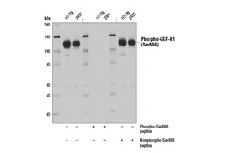 Cell Signaling Technology&nbsp;Phospho-GEF-H1 Ser886 E1L6D