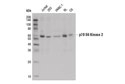 Cell Signaling Technology&nbsp;p70 S6 Kinase 2Antibody 100 u