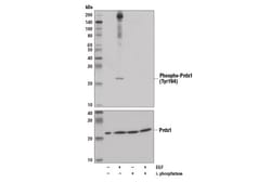 Cell Signaling Technology&nbsp;Phospho-Prdx1 Tyr194 D1T9C