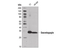 Cell Signaling Technology&nbsp;Secretagogin D4V1Y XPR Rab