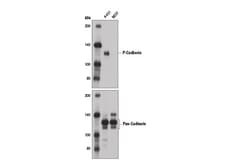 Cell Signaling Technology&nbsp;P-Cadherin 12H6 Mouse mAb 10