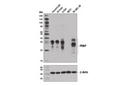 Cell Signaling Technology&nbsp;PRNP D3Q5C Rabbit mAb 100 ul