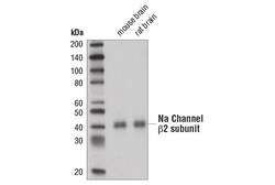 Cell Signaling Technology&nbsp;Na Channel beta-2 Subunit D6L