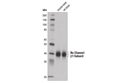 Cell Signaling Technology&nbsp;Na Channel beta-1 SubunitD4Z