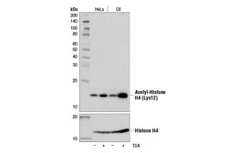 Cell Signaling Technology&nbsp;Acetyl-Histone H4 Lys12 D2W