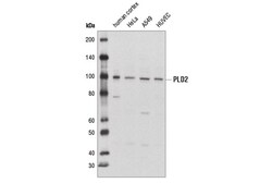 Cell Signaling Technology&nbsp;PLD2 E1Y9G Rabbit mAb 100 ul