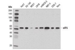 Cell Signaling Technology&nbsp;eIF5 D5G9 Rabbit mAb 100 ul