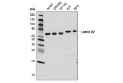 Cell Signaling Technology&nbsp;Lamin B2 E1S1Q Rabbit mAb 10